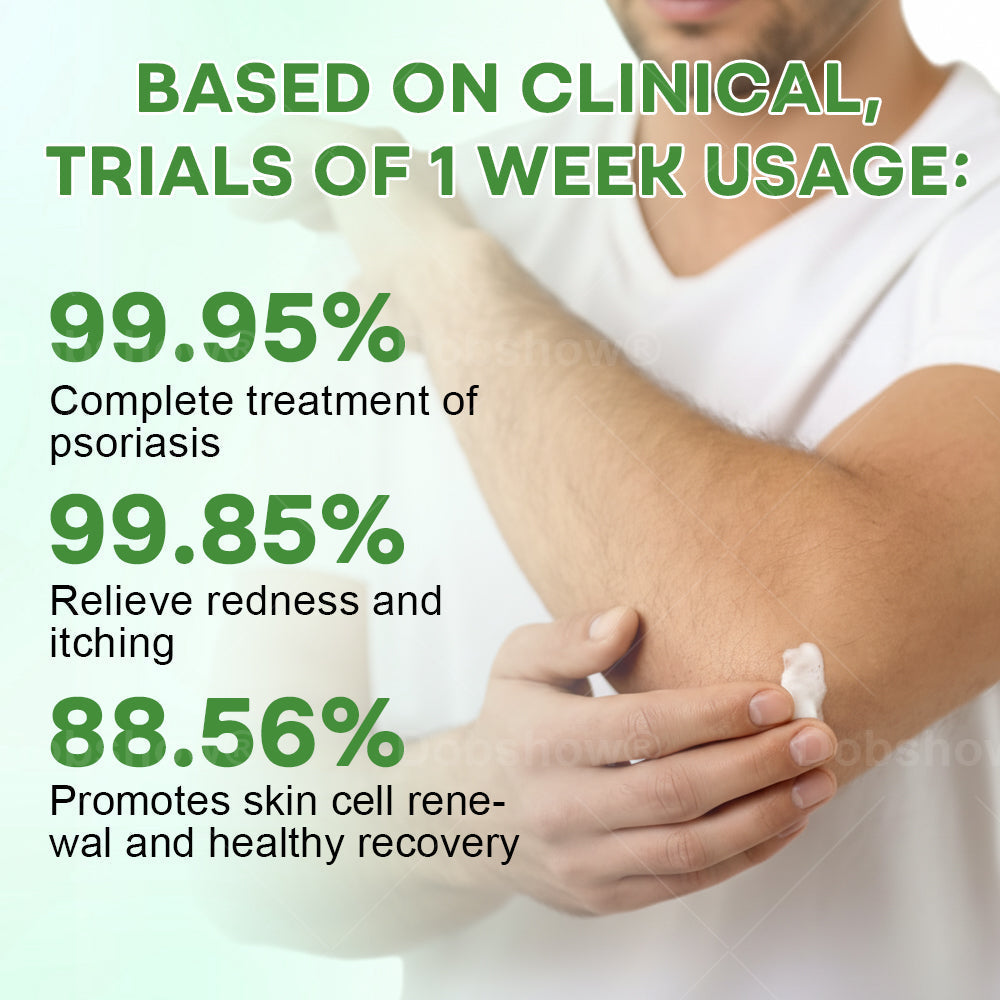 Piguiay® Herbal Psoriasis Relief Cream