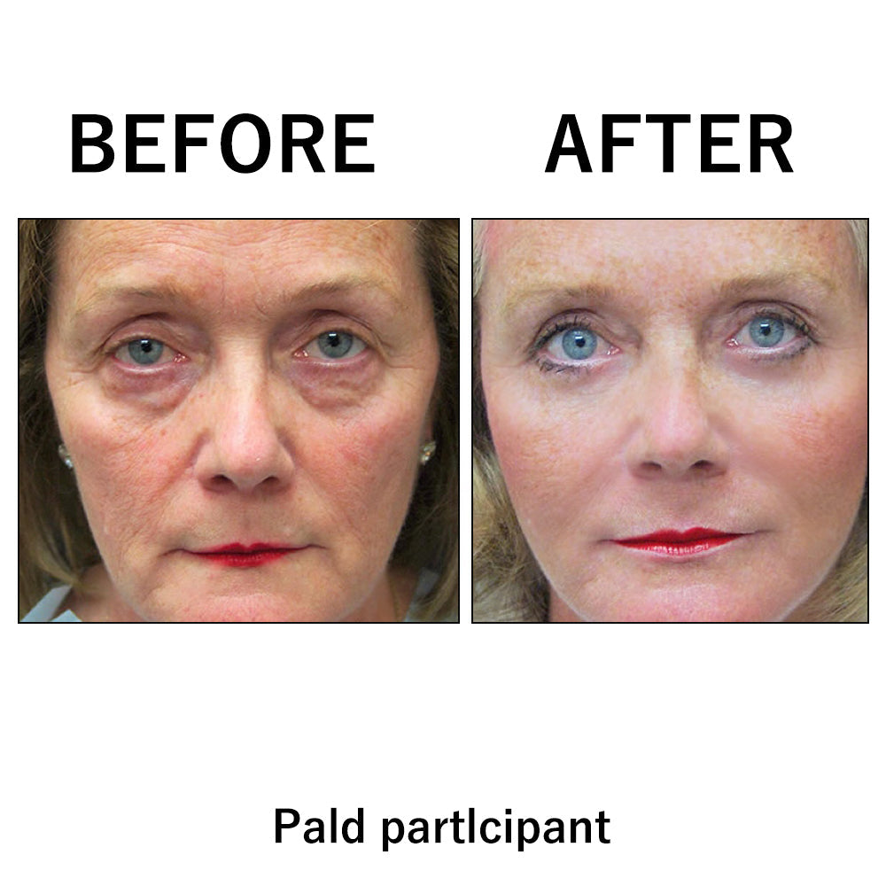 🔥 Instant Temporary Face Tightener