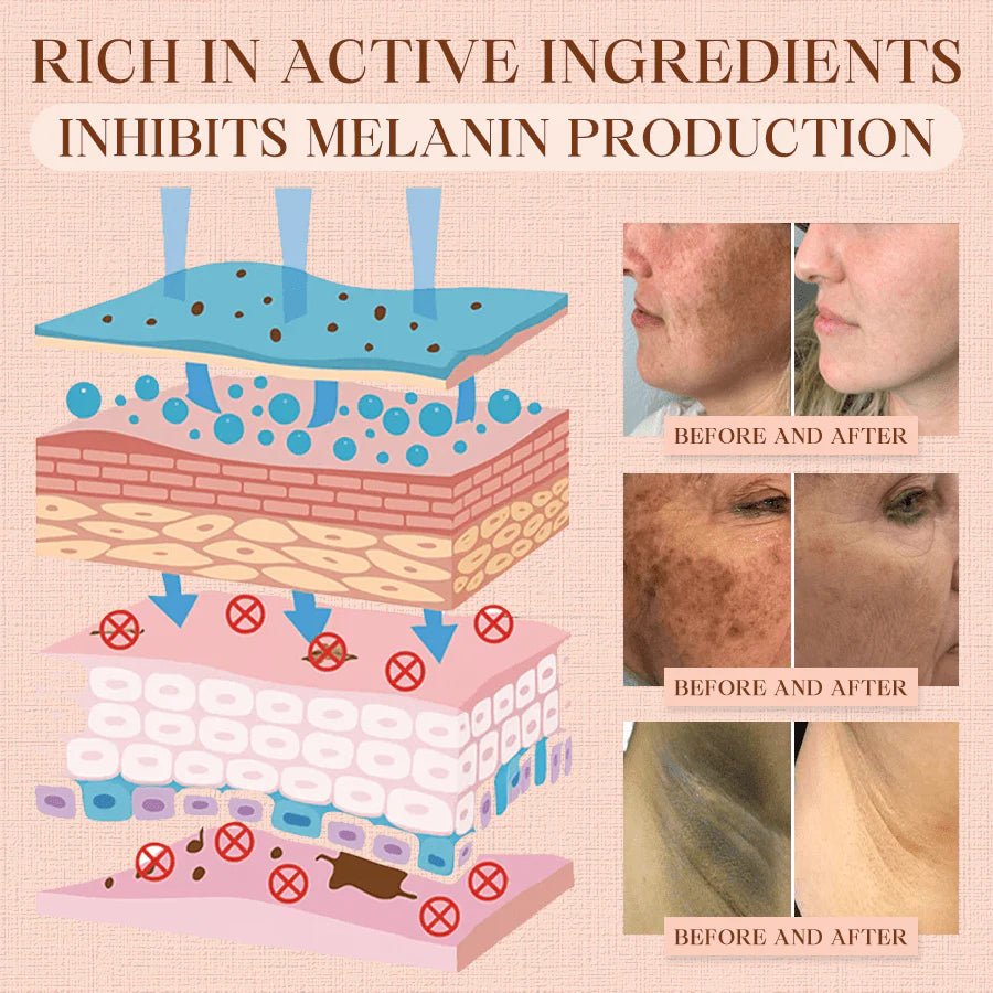 Cvreoz® Purifying Exfoliating Gel for Acanthosis Nigricans, Exfoliation, Dark Spots, Skin Tags, and Eczema