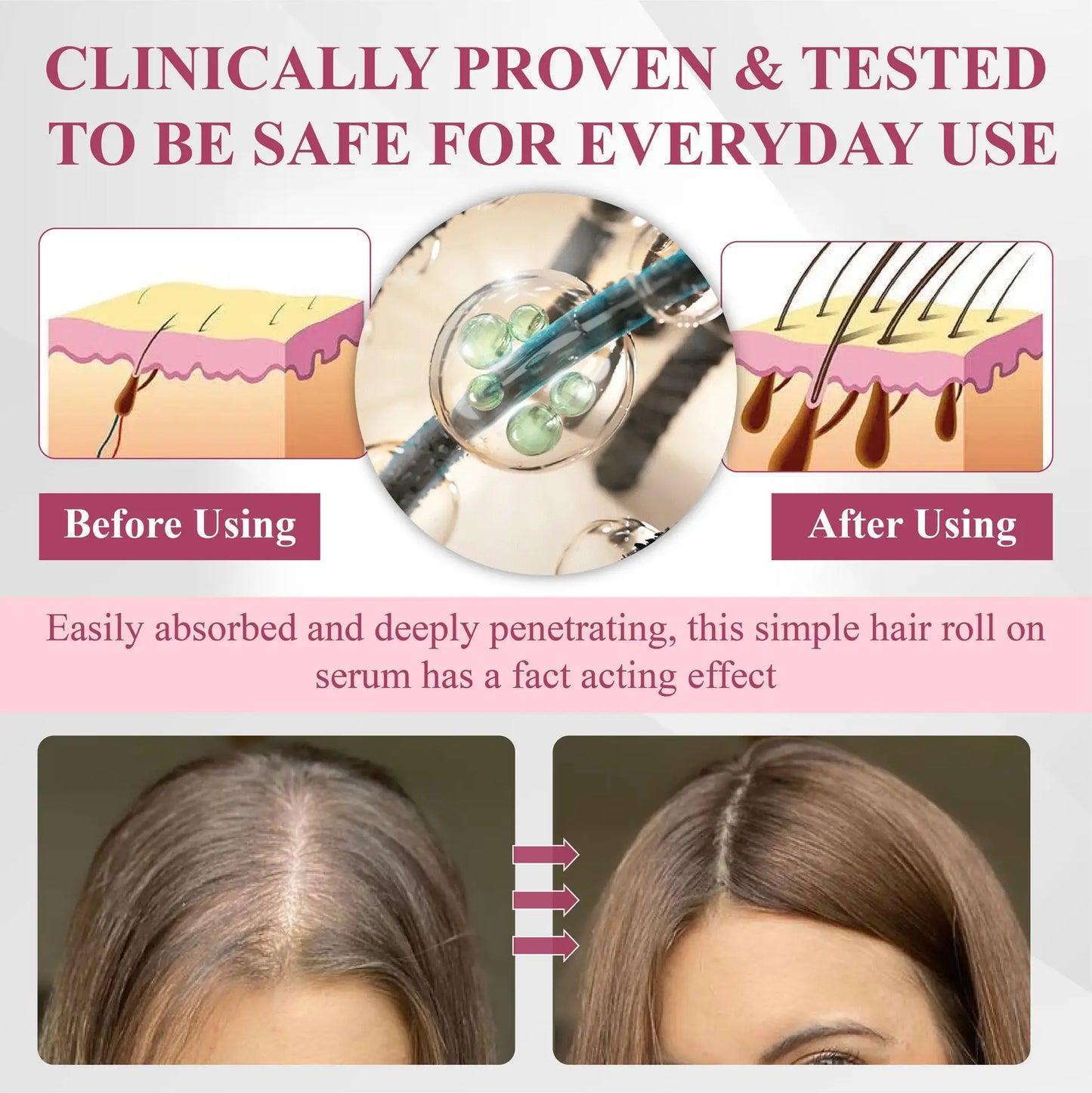 ATTDX® Hair Reawaken PP405 Roll-On Serum for Women