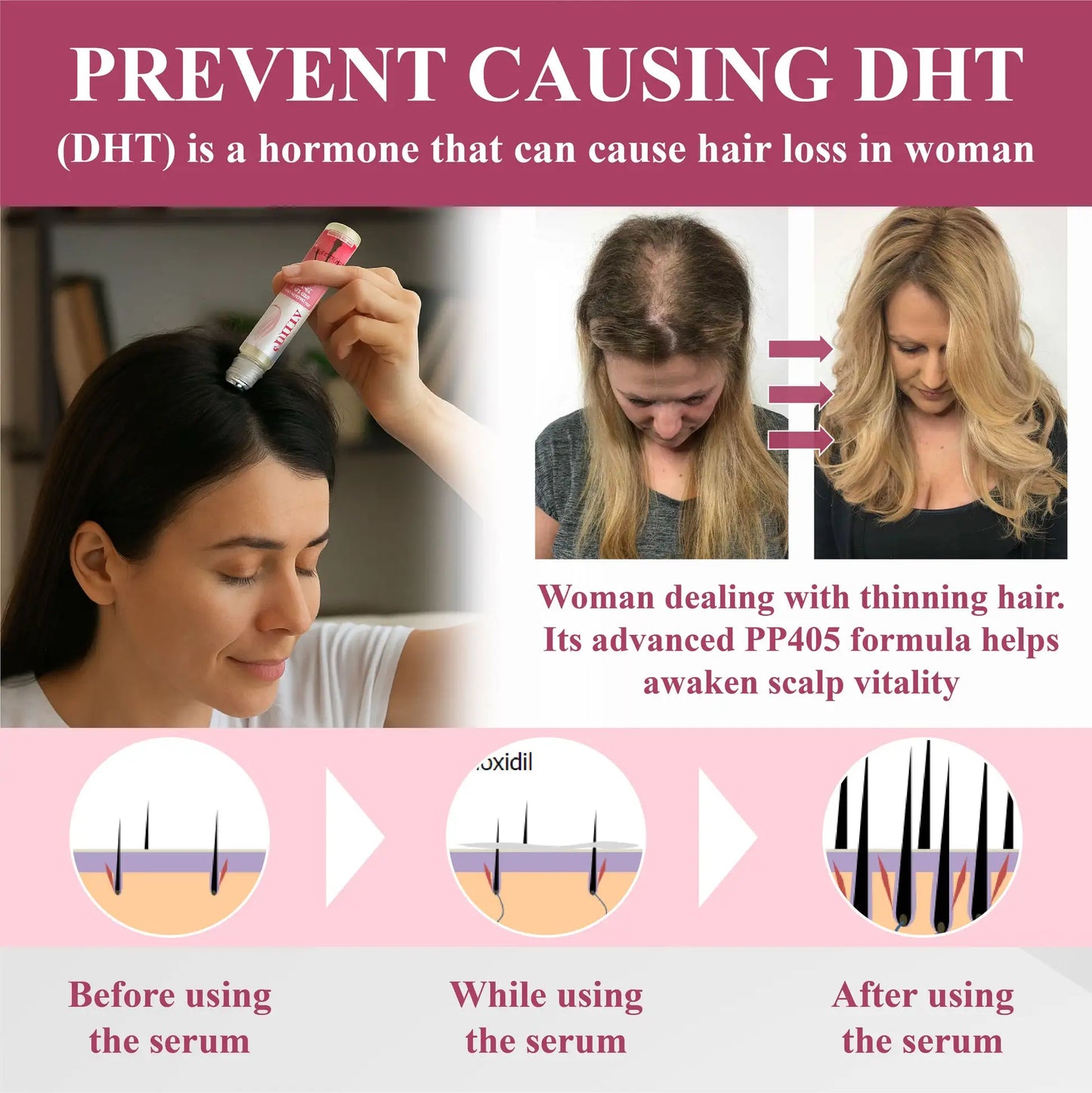 ATTDX® Hair Reawaken PP405 Roll-On Serum for Women