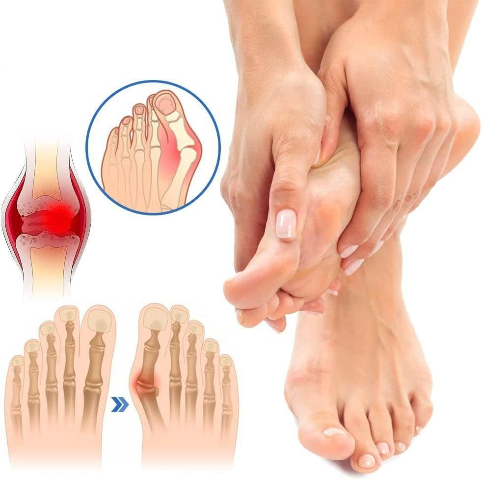 YUNPSOTM Anti - Bunion and Vein Heal Health Socks - Health Sock Bunion Relief Socks Corrector Ortho for Women & Men