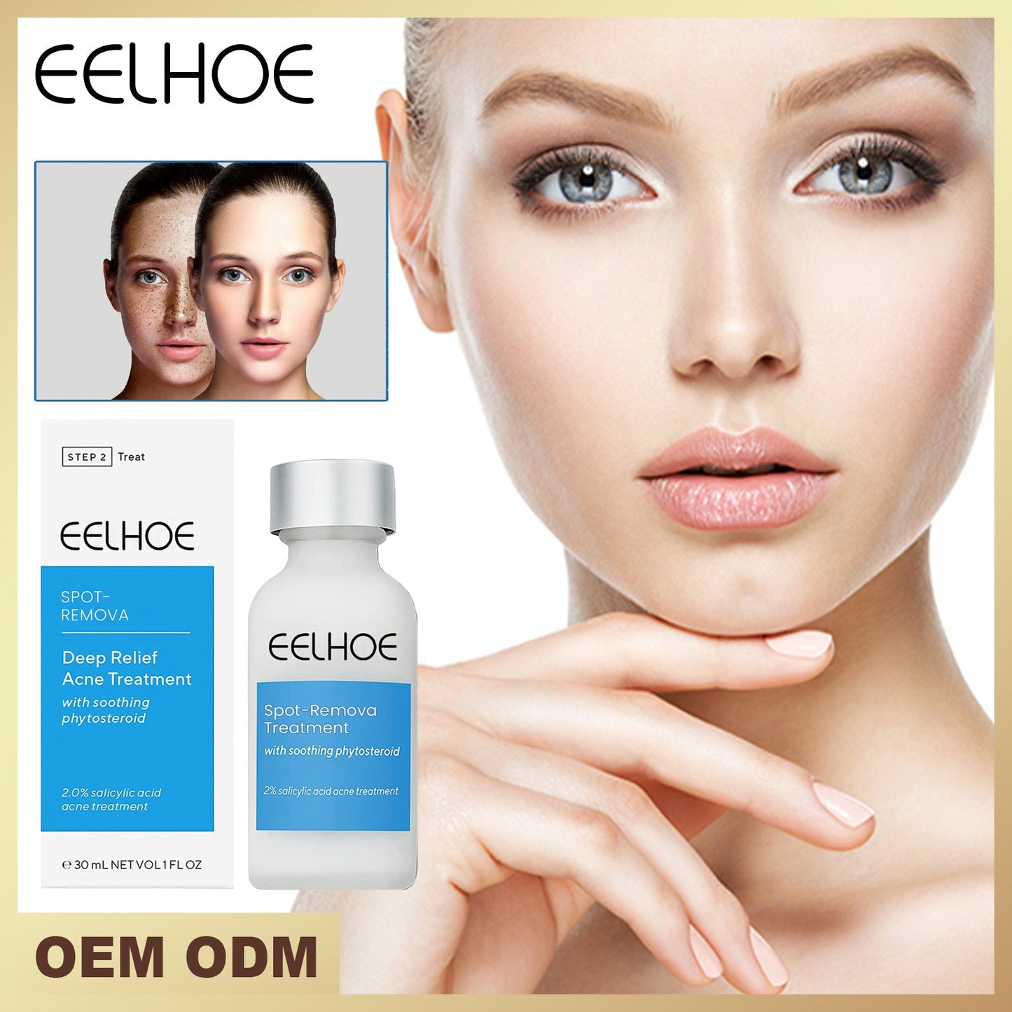 Eelhoe | Behandelingslotion | 1+1 GRATIS