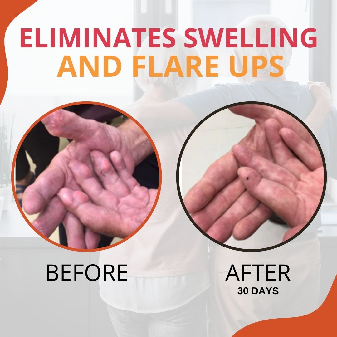 Sumifun™ Inflammatory Pain Cream（🎉Free Shipping Today Only🎉）