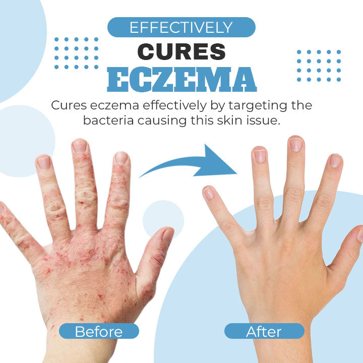 Organic Eczema Relief Repair Cream