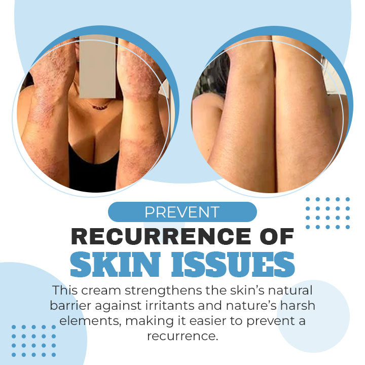 Organic Eczema Relief Repair Cream