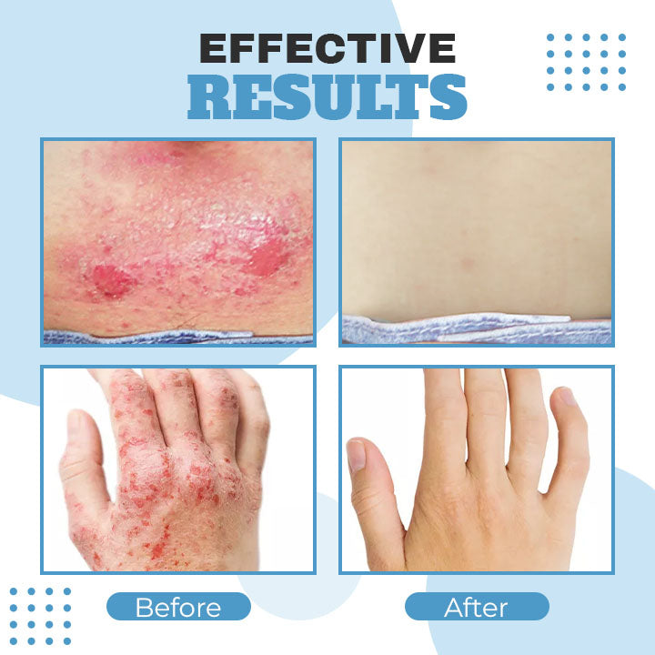 Organic Eczema Relief Repair Cream