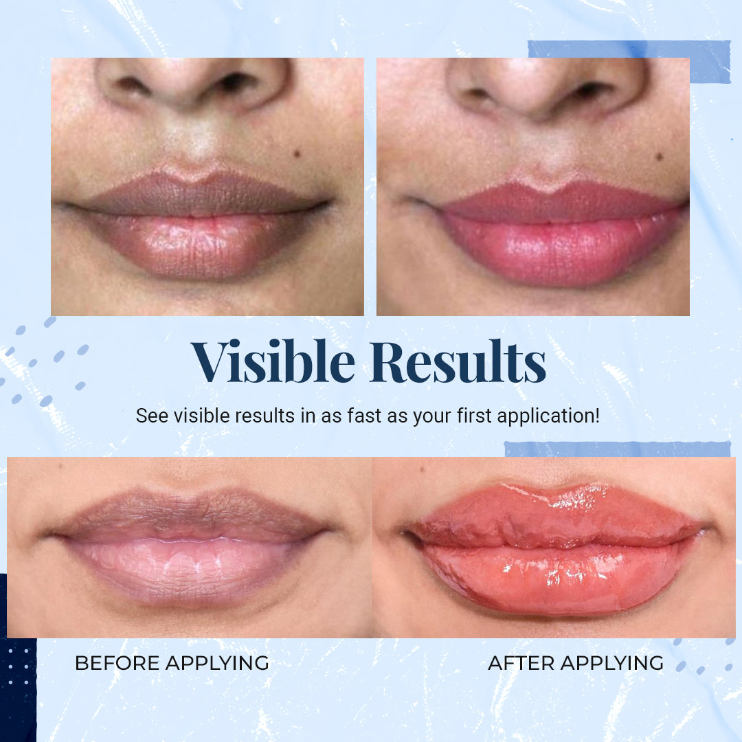 Pure Natural Melanin Reducing Lip Balm