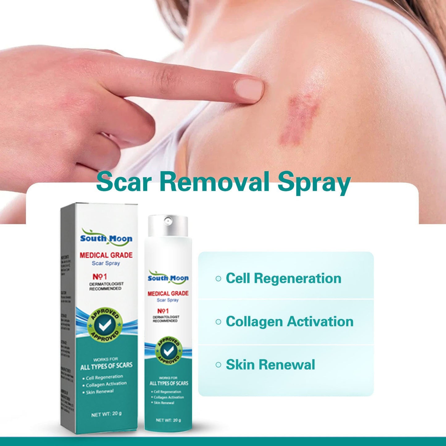 ❤️South Moon™ Advanced Scar Spray For All Types of Scars - Especially Acne Scars, Surgical Scars and Stretch Marks