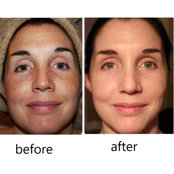 Turmeric Dark Spot Corrector Serum - Fast Acting Serum