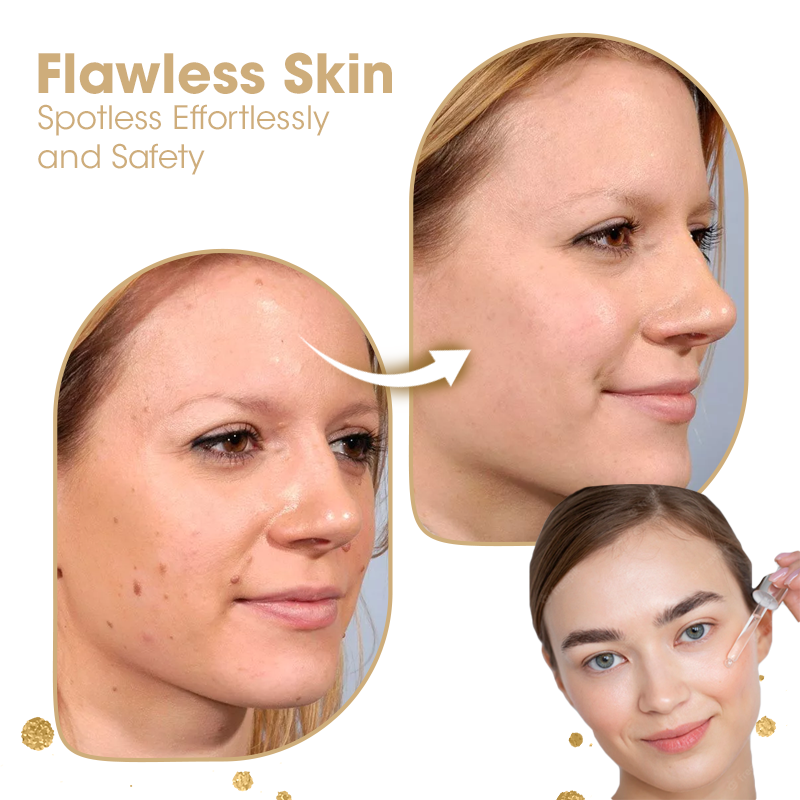 BioGlow Dark Spot Skin Serum