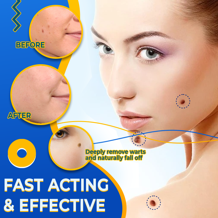 Sumifun™ Instant Wart Skin Corrector