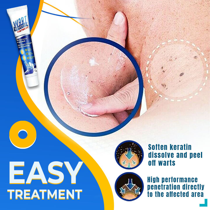 Sumifun™ Instant Wart Skin Corrector