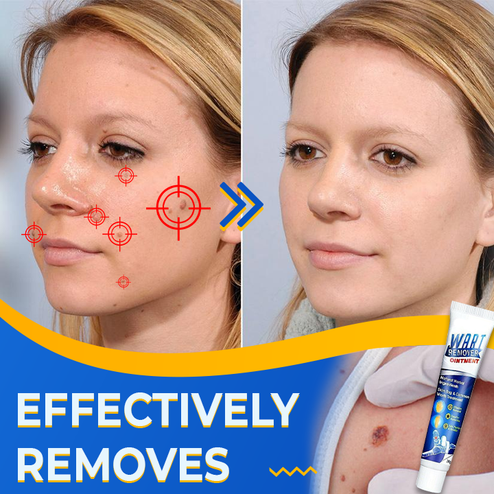 Sumifun™ Instant Wart Skin Corrector