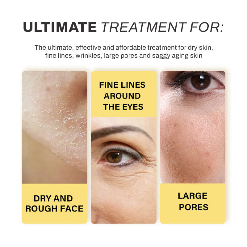 Korean ProteinThread Soluble LiftingSet