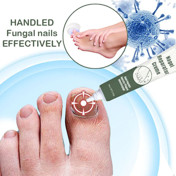 LifeMed Home Use Onychomycosis Fungus Laser Treatment