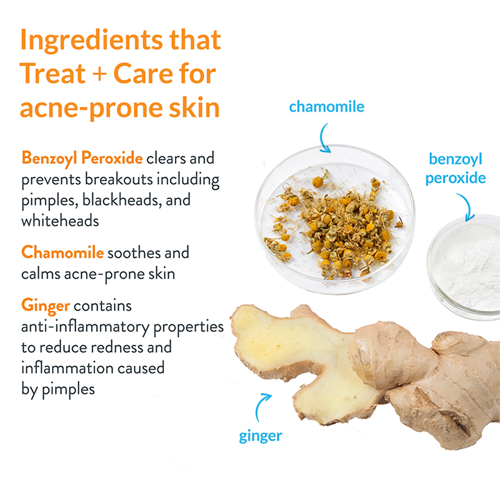 SkinAID™ Herbal Acne Removal Oil