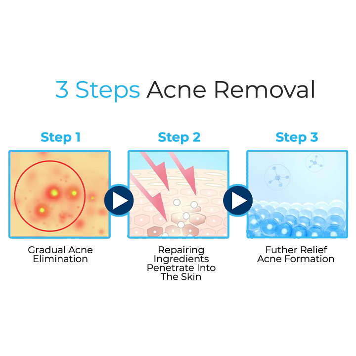 SkinAID™ Herbal Acne Removal Oil