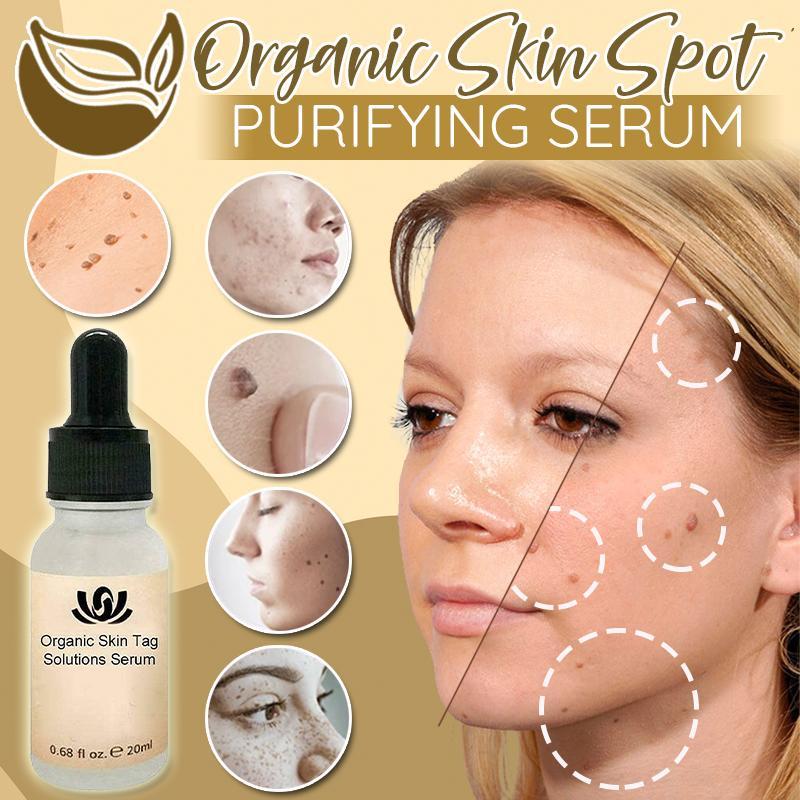 Organic Skin Spot Purifying Serum