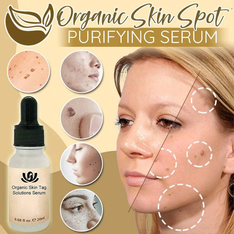 Organic Skin Spot Purifying Serum