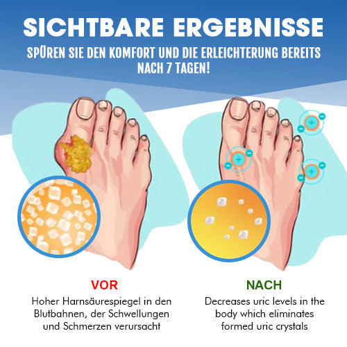 MXhealth™ Ultrasonic Ionic Gout Bangle