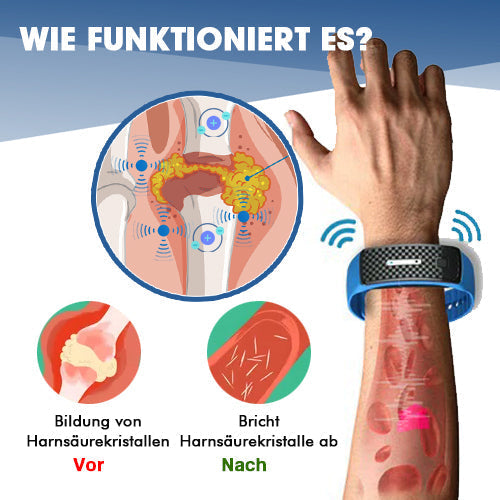 MXhealth™ Ultrasonic Ionic Gout Bangle