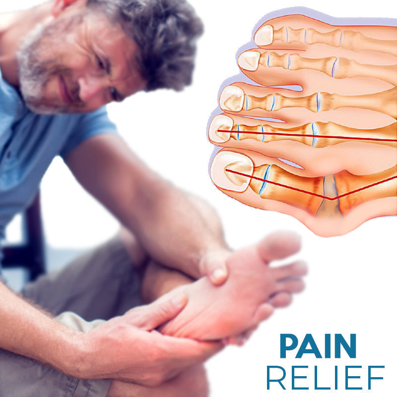 StrongJoints Adjustable Bunion Corrector