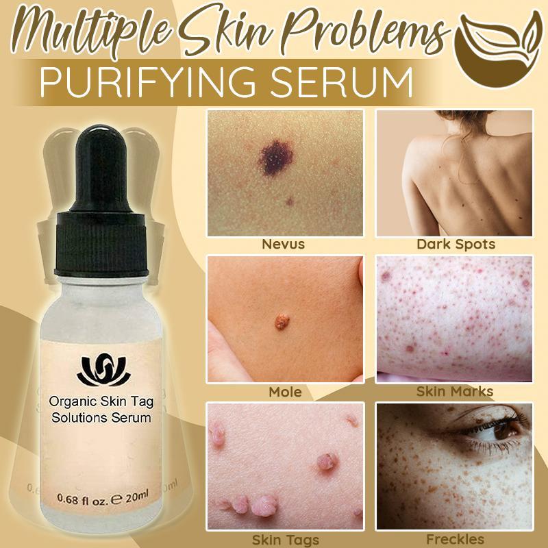 Organic Skin Spot Purifying Serum